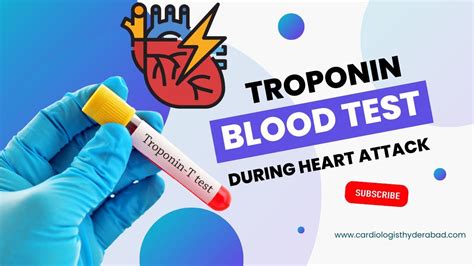 Cardiac Troponin Test: A test that detects a heart attack .